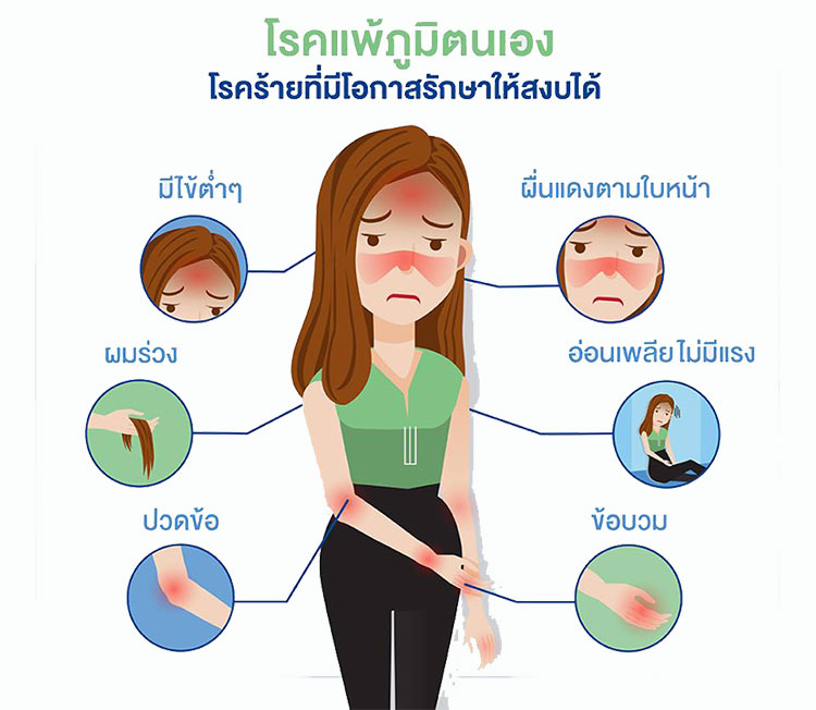 โรค-SLE-อาการ
