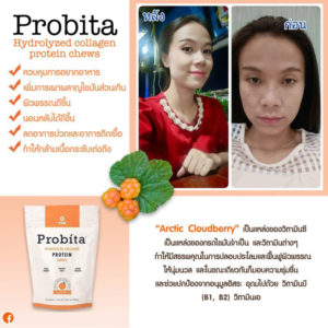 Probita-โปรบิต้า-visi-อาหารเสริม-8