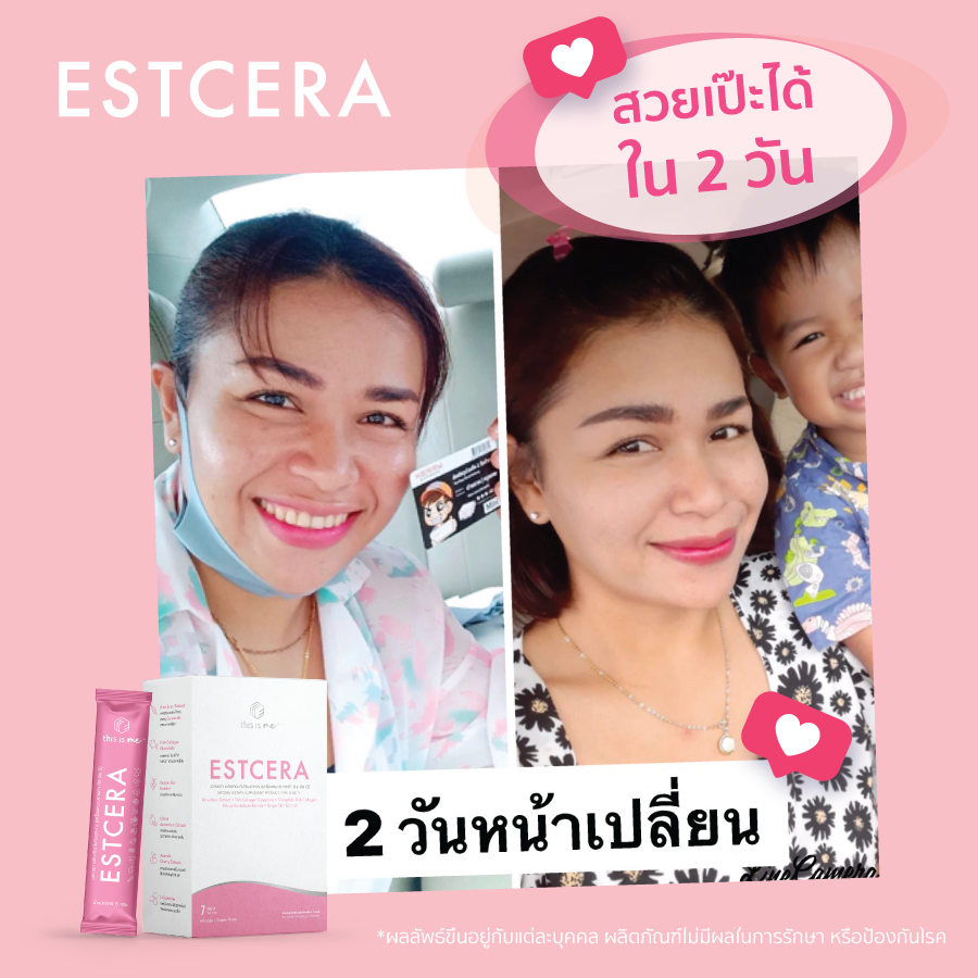 Estcera รีวิว