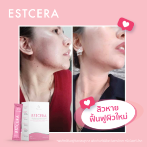 Estcera รีวิว