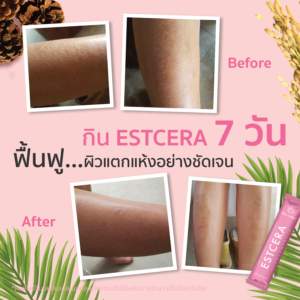 Estcera รีวิว