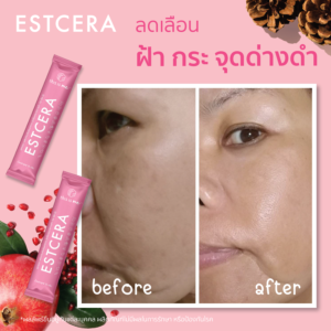 Estcera รีวิว
