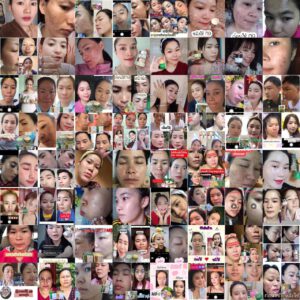 รีวิว ครีม สบู่ m9 ใช้จริง ปลอดภัย