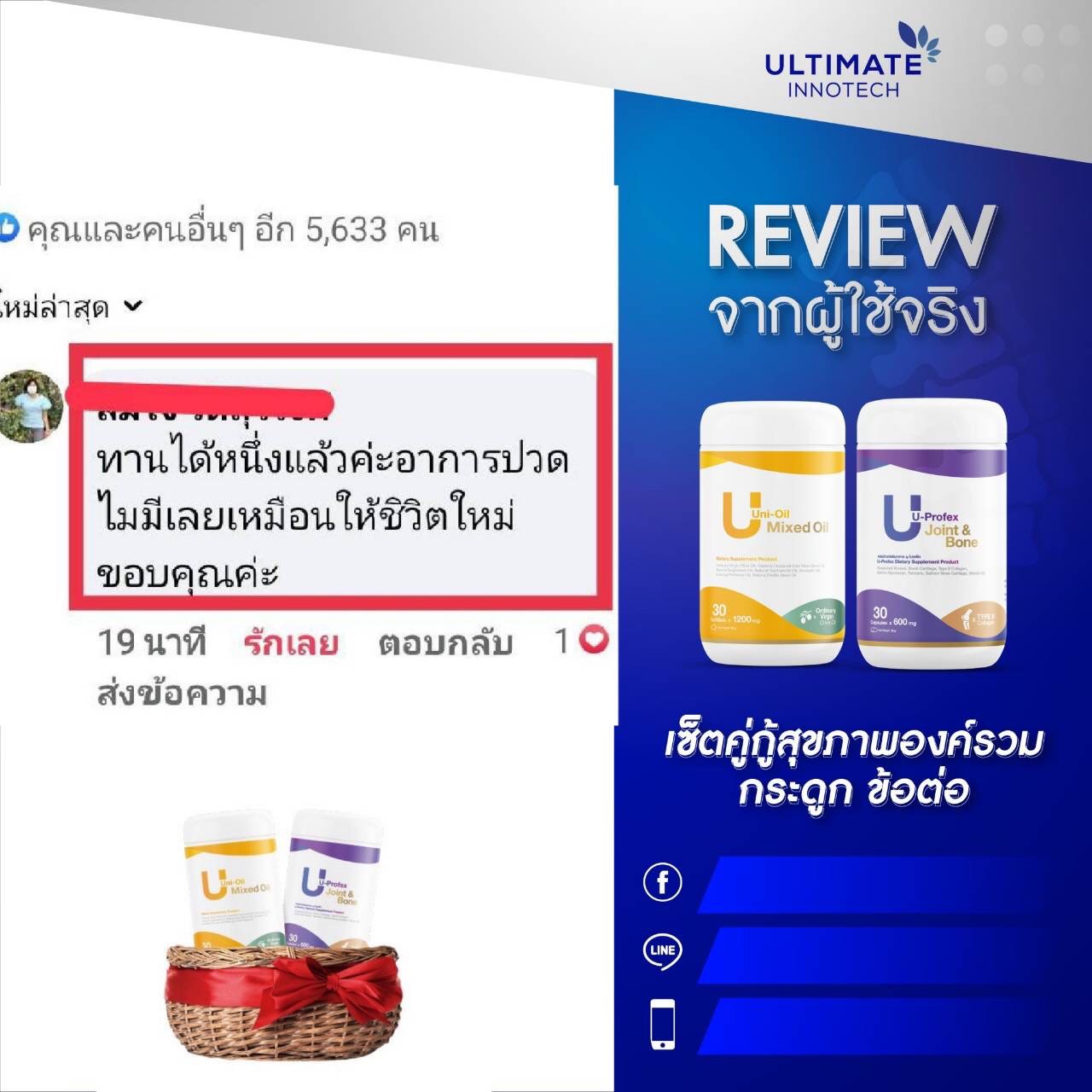 ยู โปรเฟล็กซ์ u-profex Uni oil ยูนิออย  รีวิว